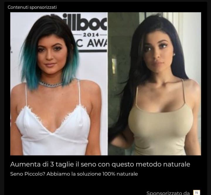 Kylie Jenner esempio di 100% naturale