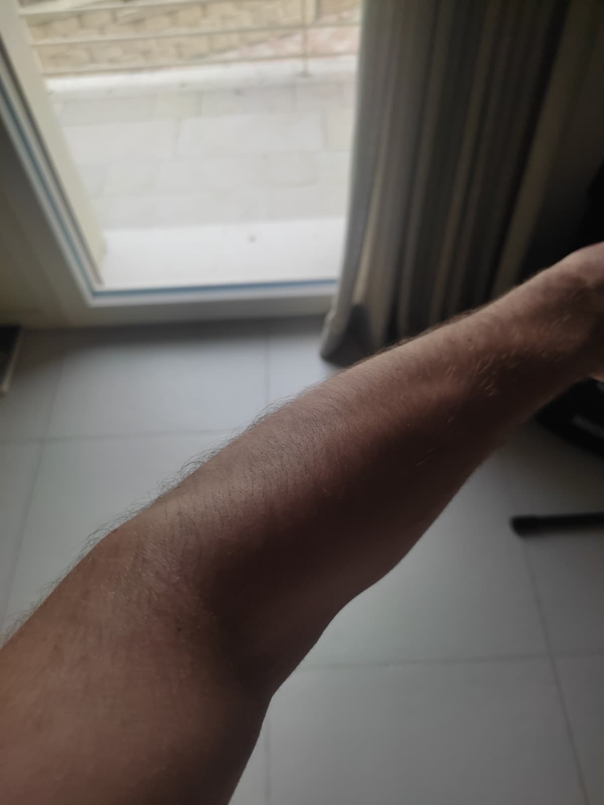 Mi sono abbronzato per spostarmi con lo scooter. Un minuto di silenzio per chi non riesce nonostante passi giornate intere sotto il sole