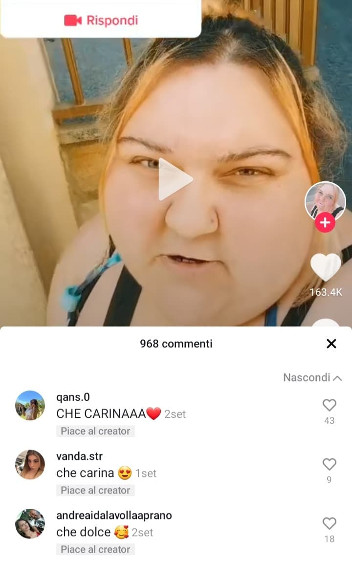 Se tutta la gente che le fa i complimenti, pensasse seriamente ciò che dice, lei sarebbe lo stereotipo di bellezza ideale che tutti vorrebbero.