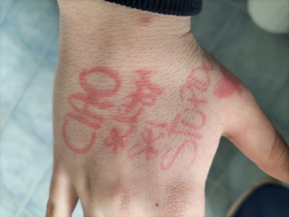 Io che mi sveglio con sta roba sulla mano senza sapere perché 