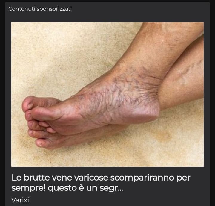 Si però che cazzo, non voglio vedere piedi e per di più con le vene varicose, che schifooooooo