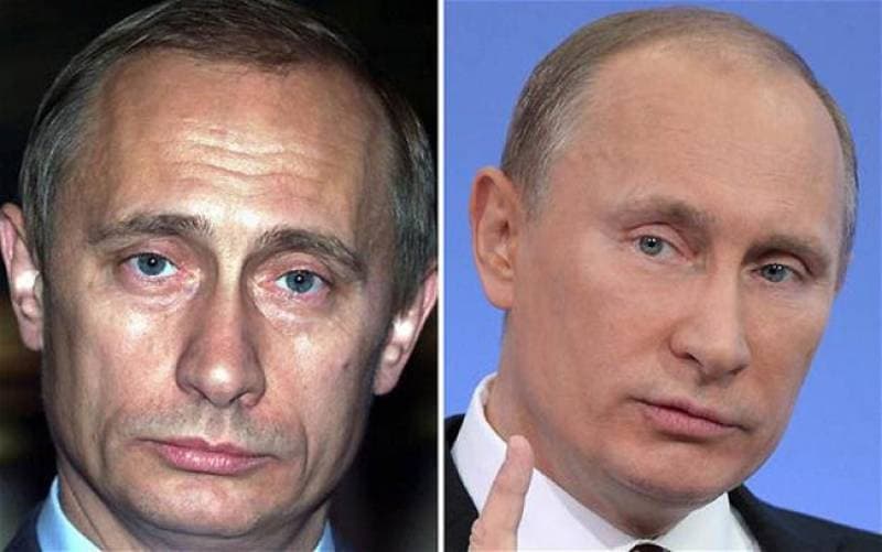 Mi sa che non è botox è cortisone e Putin sta morendo. Mi dispiace per aver pensato che fosse botox